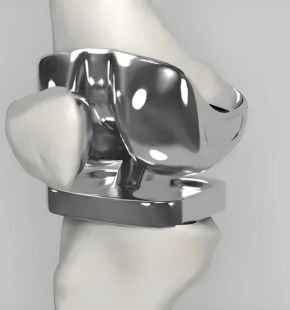 Medical device application of titanium